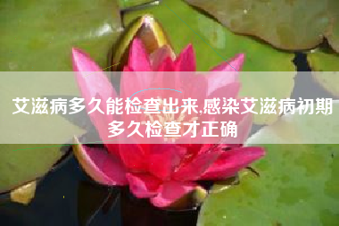 艾滋病多久能检查出来,感染艾滋病初期多久检查才正确